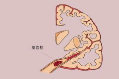 <b>管腔闭塞做三代试管可以怀双胞胎吗？大概多少钱？</b>