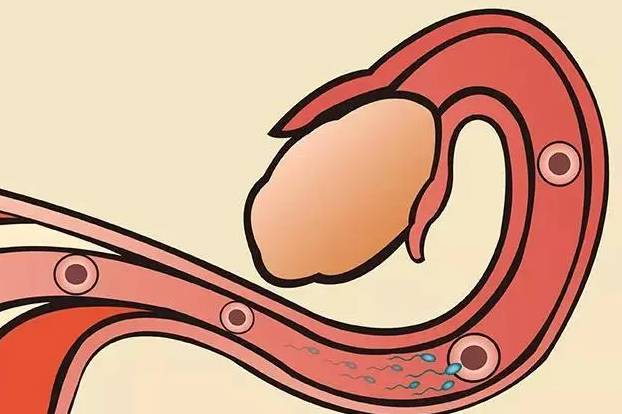输卵管通了为什么还不怀孕？有哪些原因？