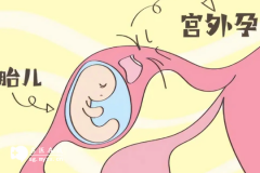 <b>避免宫外孕做好这5项工作</b>