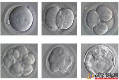 试管婴儿移植后多久算成功