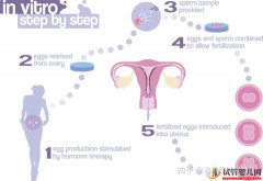 试管婴儿1代、2代、3代、4代哪个最好