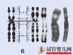 <b>6号染色体缺失、重复相关疾病汇总，不同异常对</b>