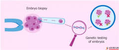 一个典型的PGD三代试管治疗周期是怎样的？