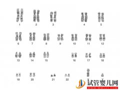 克氏综合征易导致第三性别，竟都是染色体XXY闯