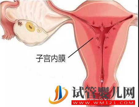 子宫内膜异位症有这4种类型,难怪症状不一样(图3)