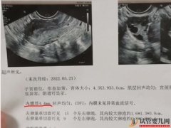 子宫内膜厚4.4mm状态正常也别急！移植最佳厚度还