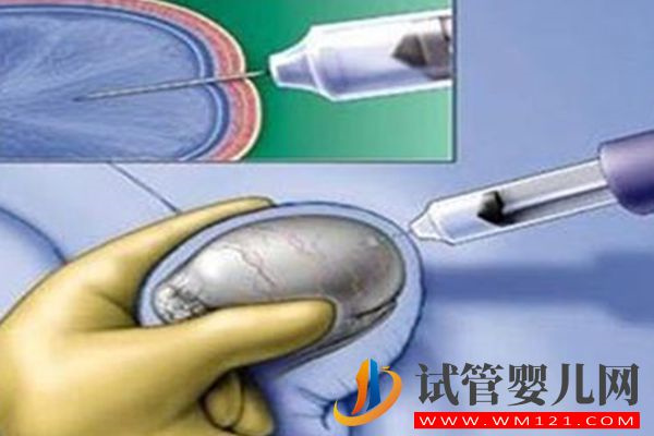 做二代试管不一定都要穿刺取精