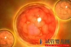 多囊卵巢综合症临床表现有那些？
