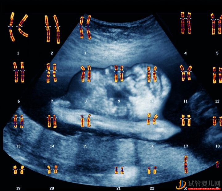为什么会连续出现胚胎染色体问题,如何避免(图6)